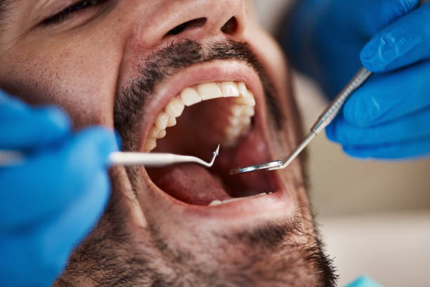 Best Cracked Tooth Emergency Dentist  in Shaw Heights, CO
